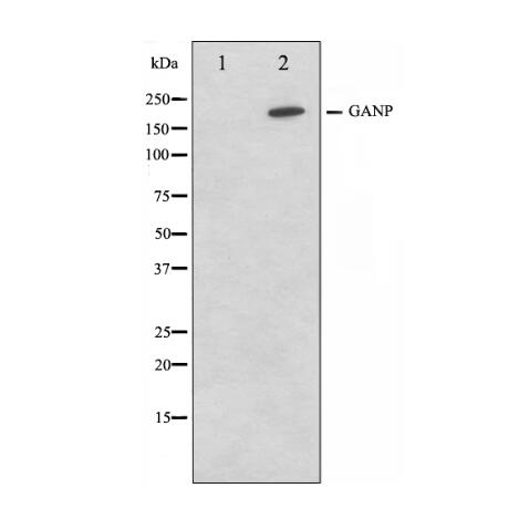 EDD Antibody 多克隆抗体